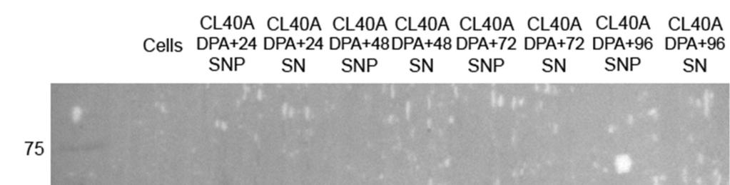 34 When it comes to CL40A, the results are in accord with CL50. Only the band at the level of the truncated ADA3 85 432 is seen, more intensively on the SNP than on the SN lanes.