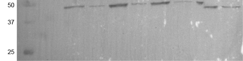 WB analysis for CL40A samples (DPA+24 to DPA+96). 4.2.5 Large scale expression Following the addition of the second passage of virus (V 1), the cells stopped dividing after 24 h.