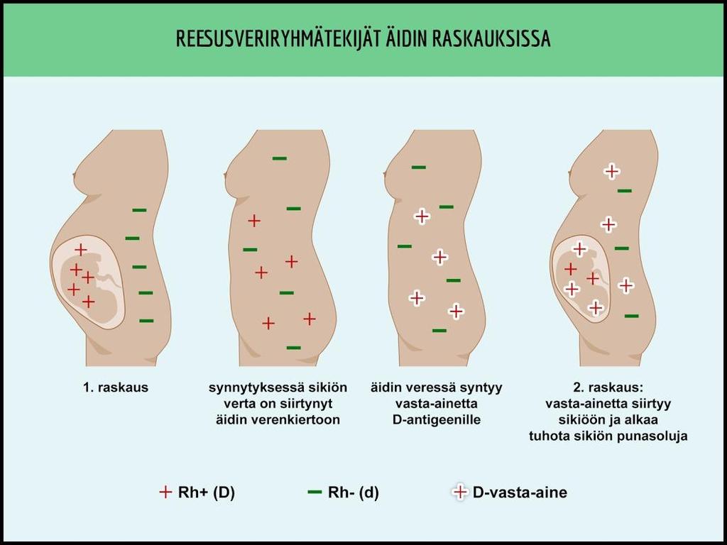 Rh-veriryhmäjärjestelmä Kell-veriryhmäjärjestelmä ABO:n jälkeen seuraavaksi merkittävin järjestelmä Immunogeeninen Huomioidaan aina verensiirroissa Rhesustekijöitä useita, tärkein D-tekijä.