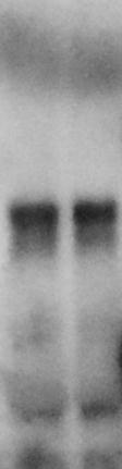 () Detection of the input proteins for