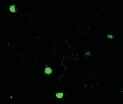 epidermis cells.
