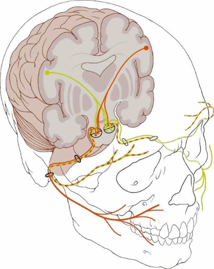 Liite 1 Moodlen ennakkomateriaali Kuva 2 - Kuvassa demonstroidaan kasvohermon kasvojen yläosan bilateraalista hermotusta VIII nervus vestibulocochlearis eli kuulotasapainohermo Kuulo- ja