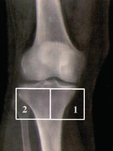B (B) lateral view: (3) tibial