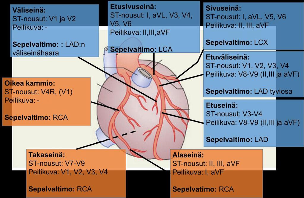24 Kuvassa 11 on järjestetty jokaiseen laatikkoon infarktin sijainti, missä kytkennöissä muutokset näkyvät, sekä mistä suonesta tukkeuma on mahdollisesti löydettävissä. Kuva 11.