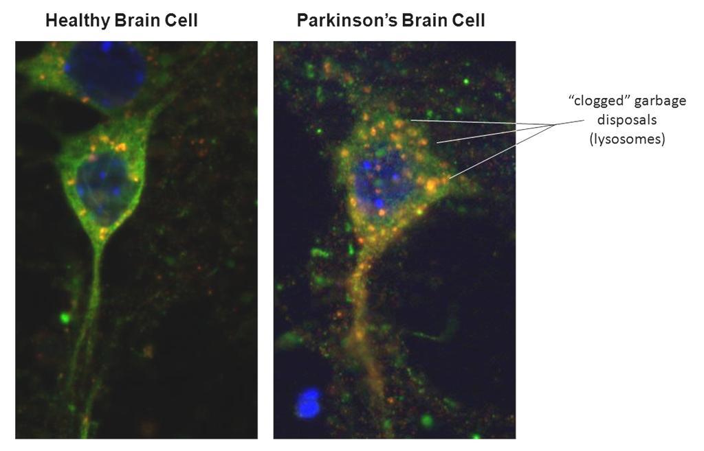 : Alzheimer s and Parkinson s deseases S.