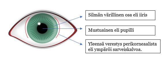 18 4.7 Värikalvotulehduksen lääkkeitä KUVA 6. Silmän havainnekuva, värikalvo. Värikalvotulehdus eli iriitti esiintyy tyypillisesti vain toisessa silmässä.