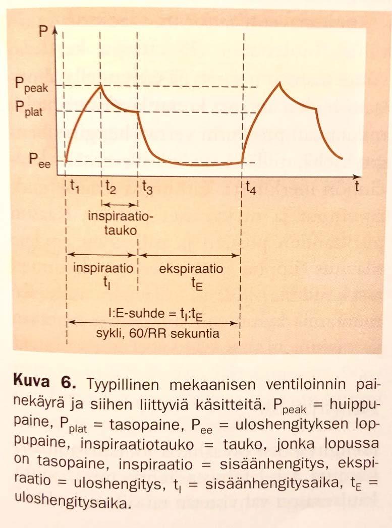 Anestesiaventilaattorin painekäyrä ja sen