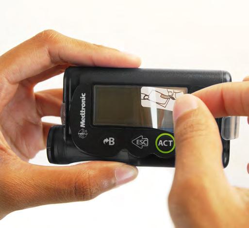 Yhteensopivia MiniMed 640G - ja MiniMed 670G -pumppujen kanssa Saatavilla viidessä eri värissä: musta,