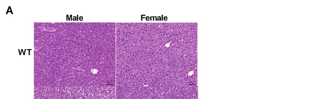 Results and Discussion 63 Figure 7 Hepatic histology and triglyceride accumulation of obese OE-NPY DβH mice (A) Representative hematoxylin and eosin (H&E) stained liver specimens of homozygous