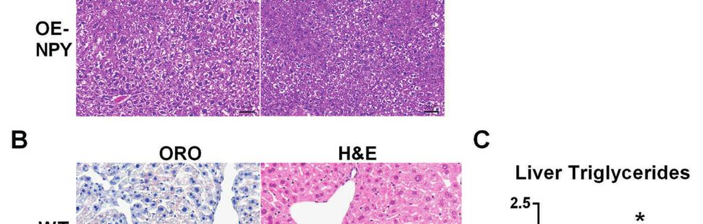 (B) Representative oil red O (ORO) (scale bar 100µm) and H&E (scale bar 50µm) stained liver specimens, and (C) quantitative triglyceride content of 7-month-old male OE-NPY DβH vs.