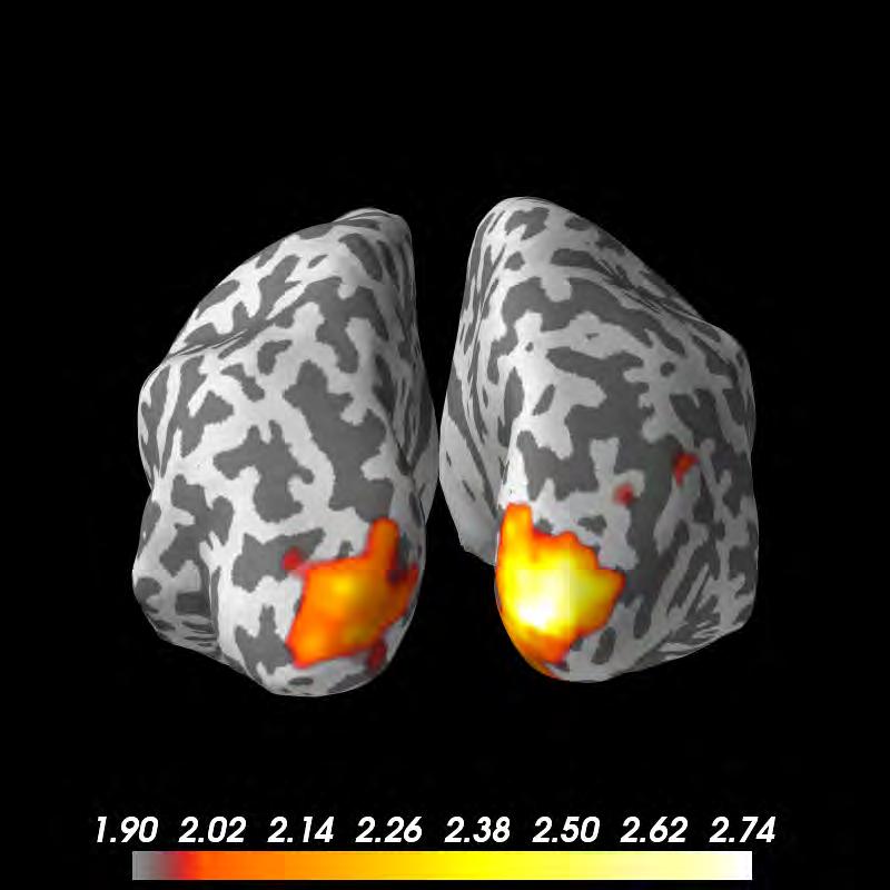estimate (DICS beamformer) Stimulus on N
