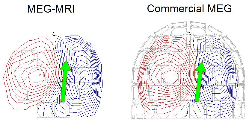 MEG-demonstraatio hybridilaitteella Checkerboard stimulus presented in the lower left visual quadrant Interstimulus interval 1 s Average