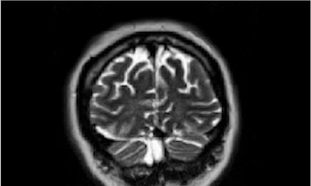 MEG MRI: lähiajan näkymät