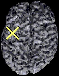 TMS EEG