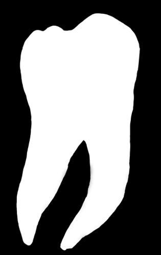 WT-3 WT-2 WT: Työskentelypituus One Curve Vastaava yhden viilan