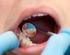 Yleissairauksien aiheuttamat suun limakalvomuutokset
