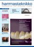 Mondial-hampaat - parasta laatua implanteille ja proteeseille: